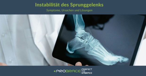 Instabilität des Sprunggelenks – Symptome, Ursachen und Lösungen