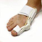 hallux valgus teenspalk